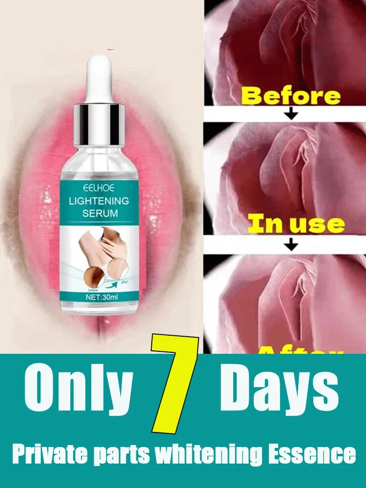 Perfume Zara - Huid Whitening Serum Private Delen Oksels